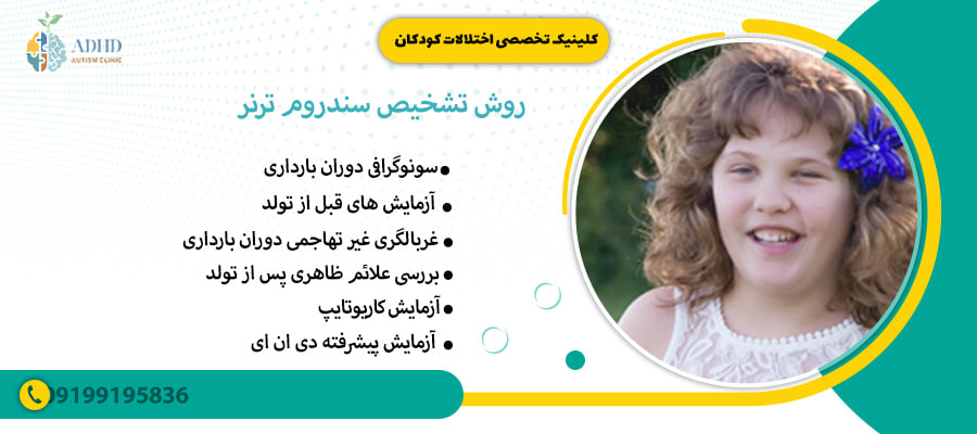 روش تشخیص سندروم ترنر